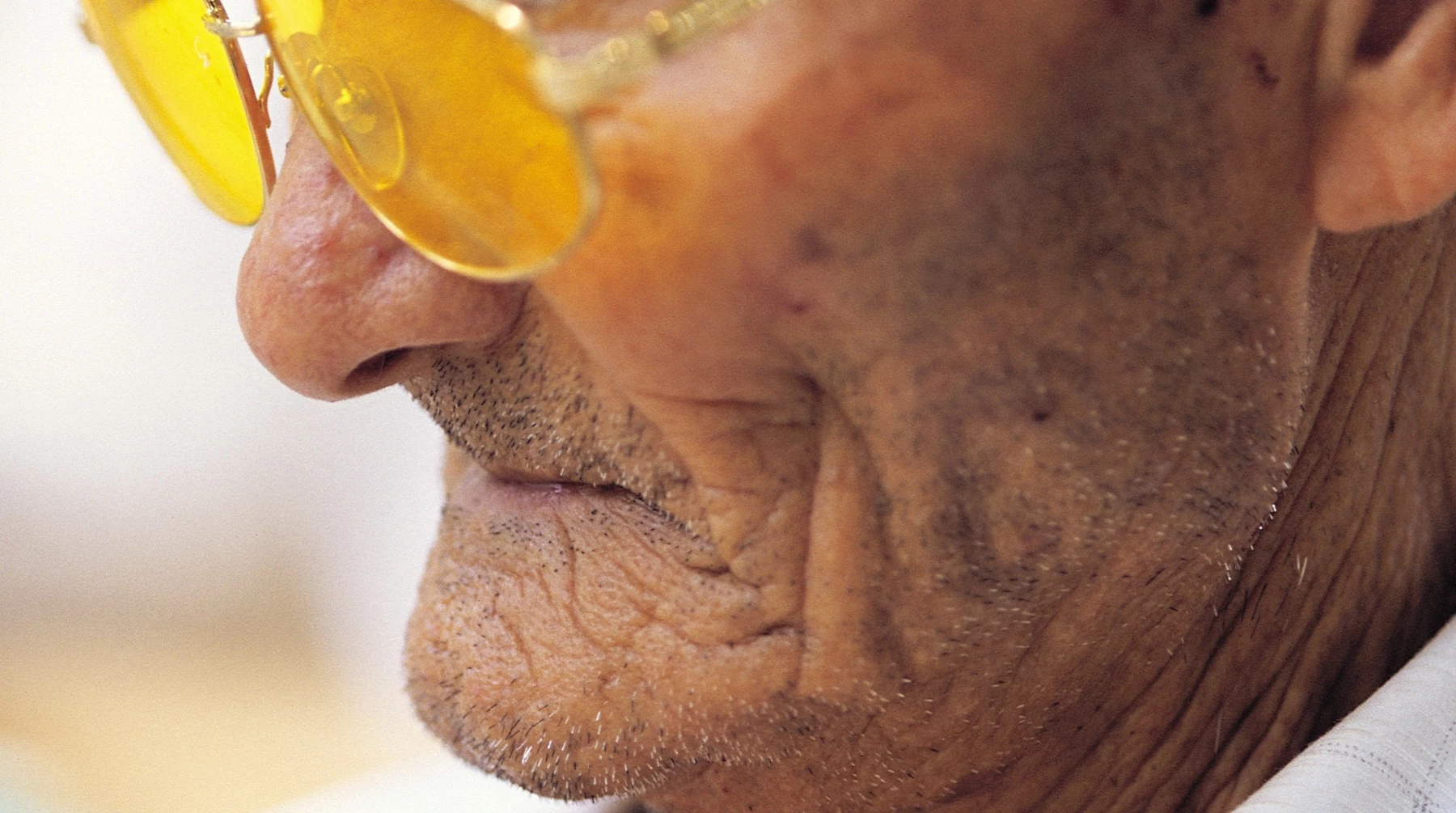 Elderly Man's Nose